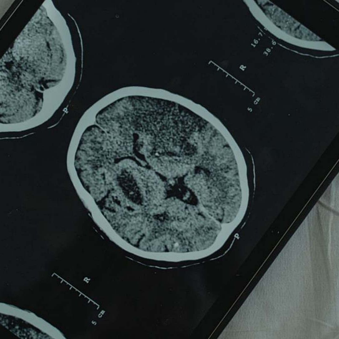 La investigación se basó en datos de resonancias cerebrales de 3 mil 802 personas de entre 0 y 90 años. Foto: Canva | Ilustrativa