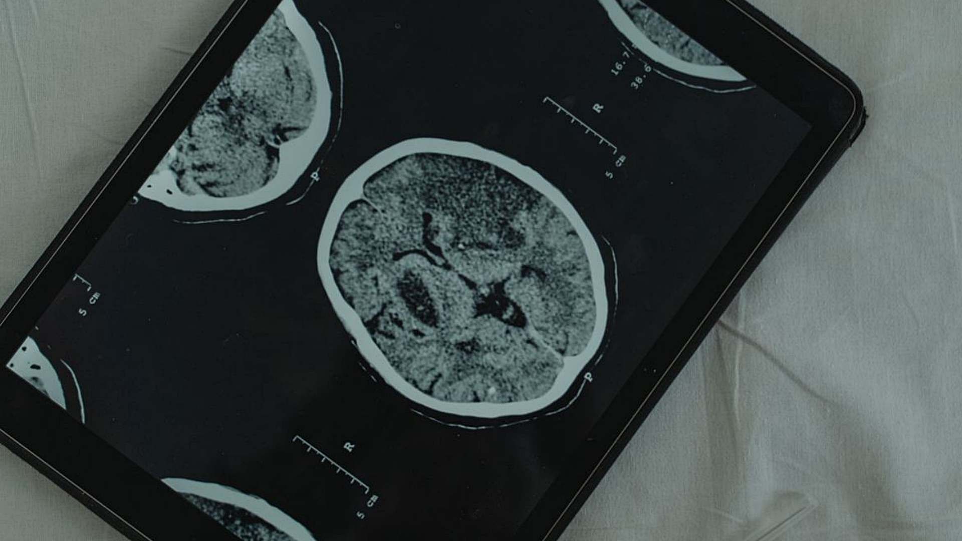 La investigación se basó en datos de resonancias cerebrales de 3 mil 802 personas de entre 0 y 90 años. Foto: Canva | Ilustrativa