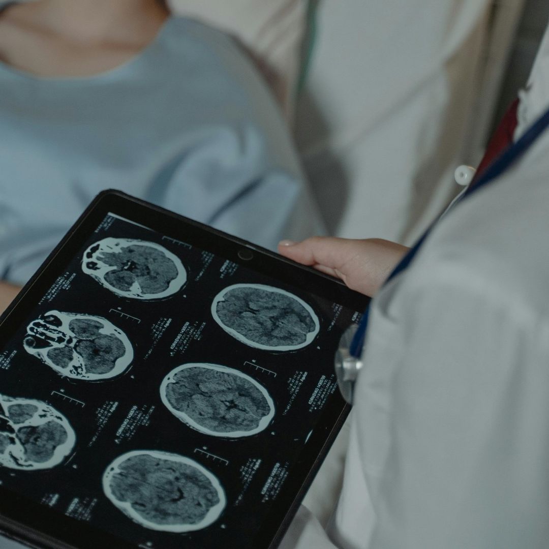 Estudios a cerebros de pacientes
