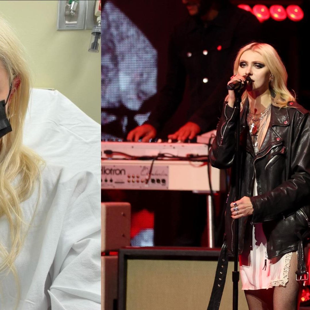 Así Quedó la Pierna de Taylor Momsen Tras Sufrir Mordedura de Araña Venenosa en México