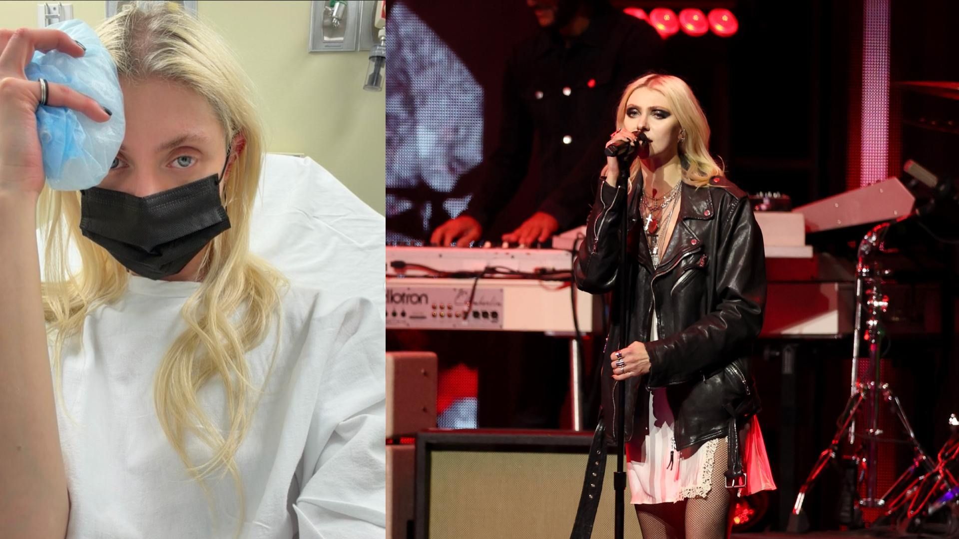 Así Quedó la Pierna de Taylor Momsen Tras Sufrir Mordedura de Araña Venenosa en México