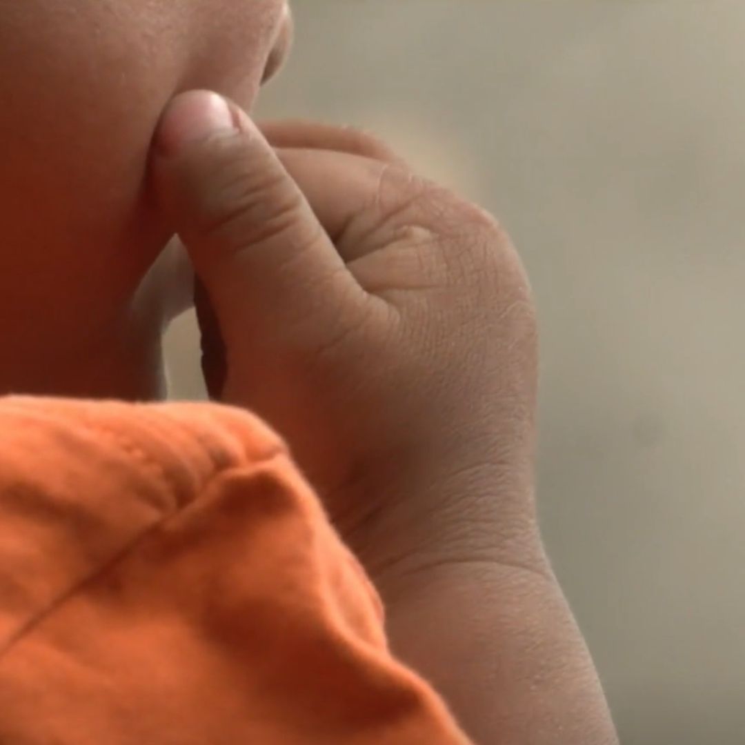 Niño Samuelito Está Afectado Luego de Ser Apuñalado en la Cabeza