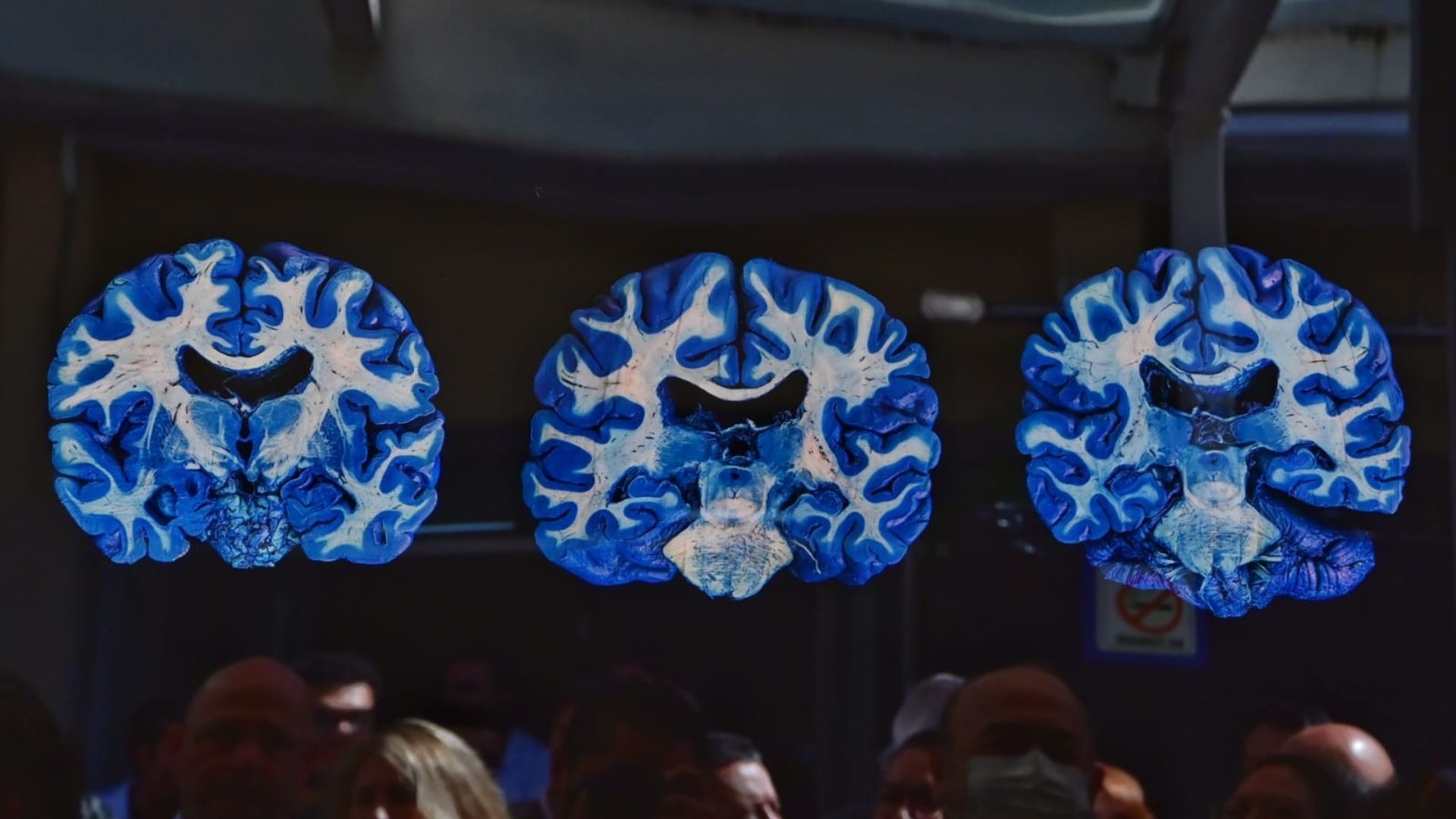 Fotografía El Cerebro Azul
