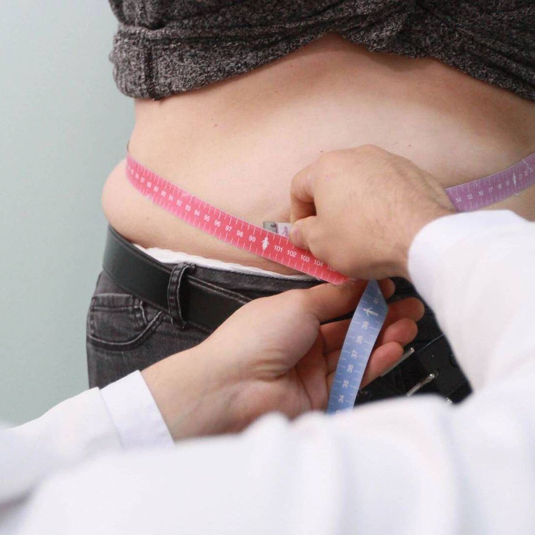 ¿Qué Es la Gordofobia? Discriminación Atenta contra Salud Mental y Genera Rechazo Social