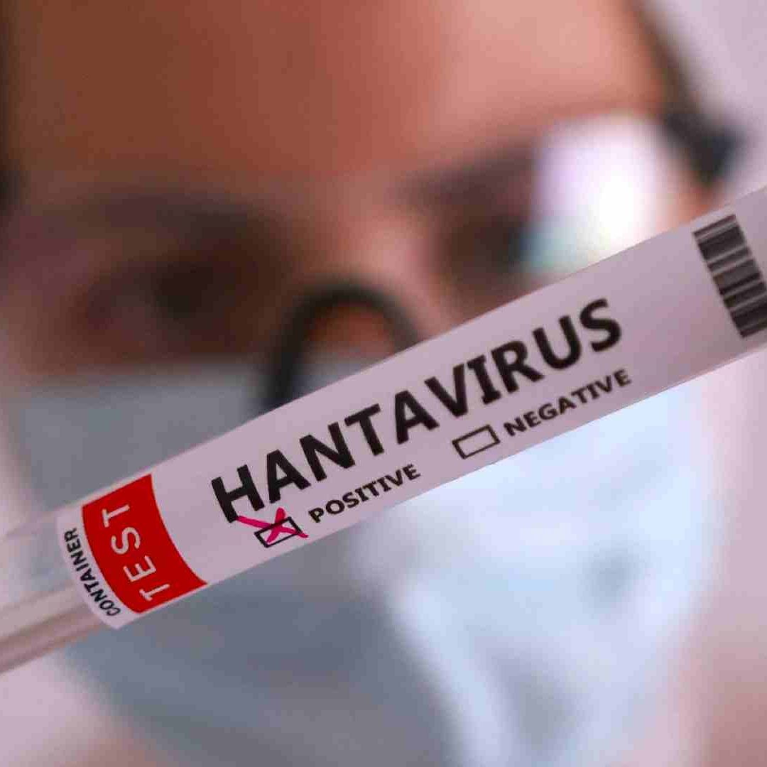 Ana Vigueras, especialista de la UNAM, explica todo lo que debes saber del hantavirus