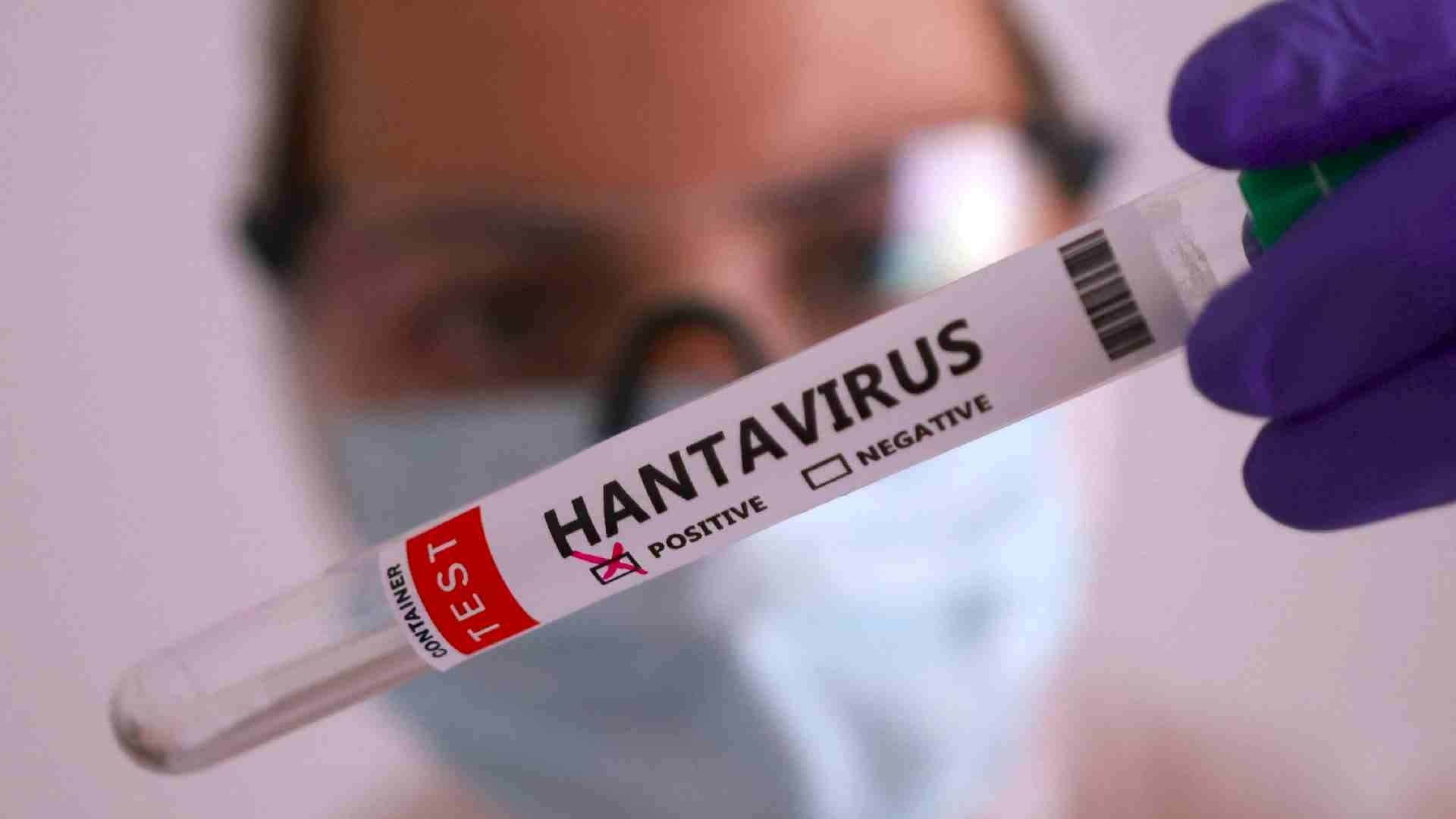 Ana Vigueras, especialista de la UNAM, explica todo lo que debes saber del hantavirus