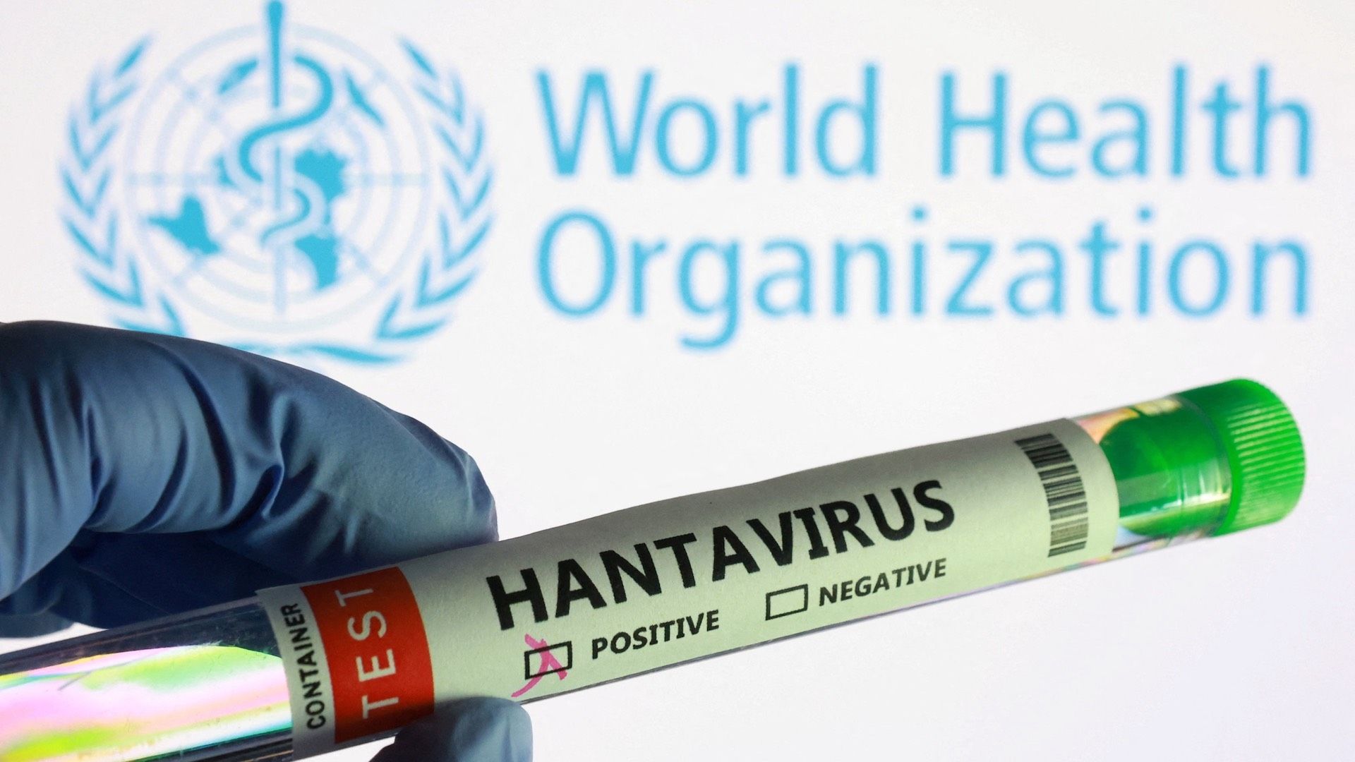 ¿Qué países están en alerta por hantavirus Andes?
