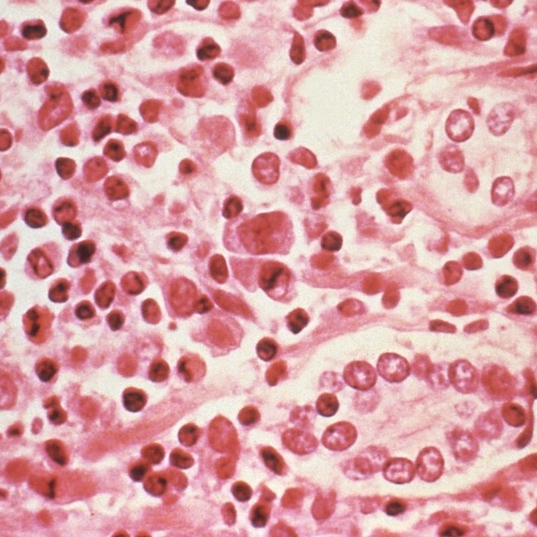 Tejido expuesto al hantavirus bajo el microscopio