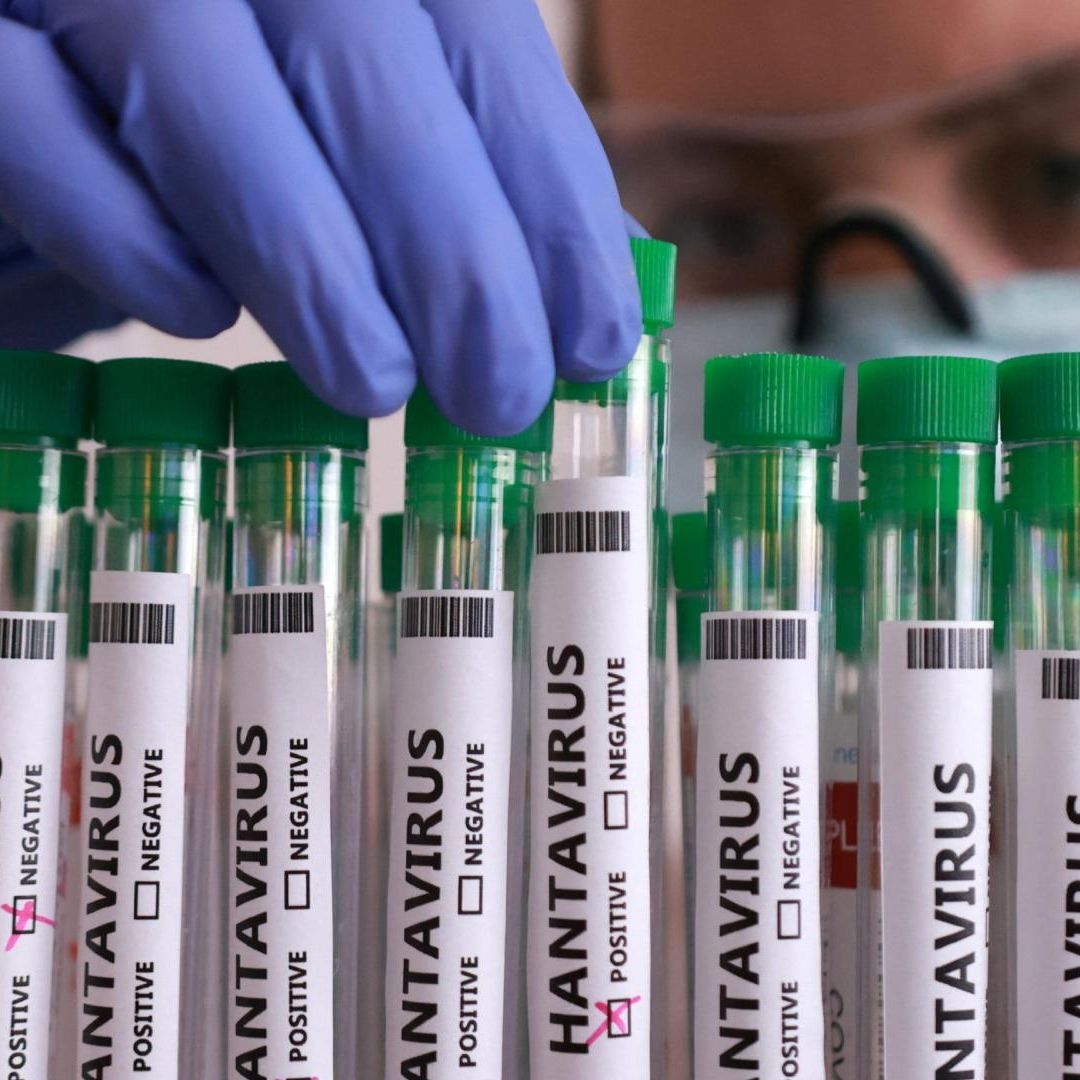¿Qué Tan Letal Es el Hantavirus?