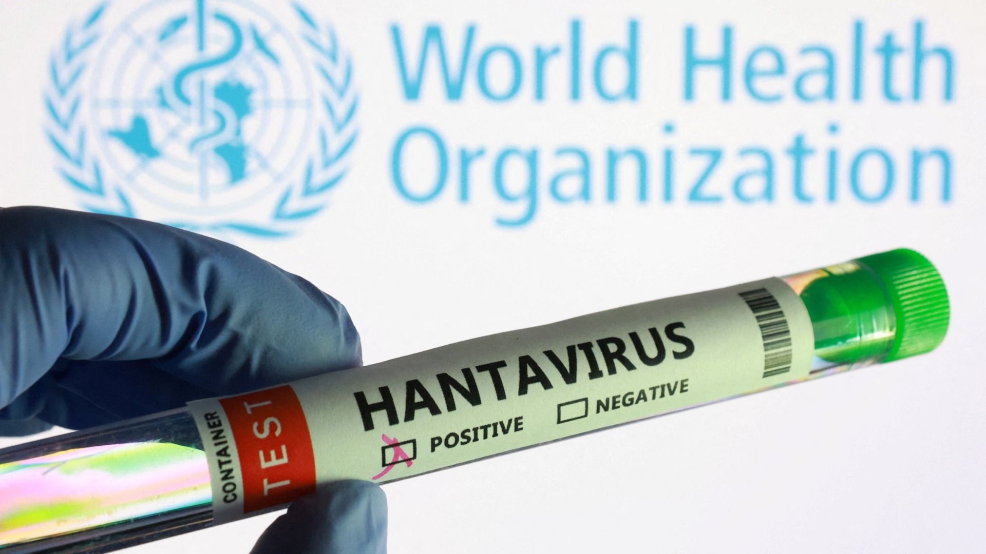 Caso Hantavirus