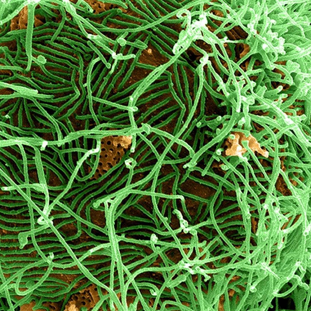 Ébola