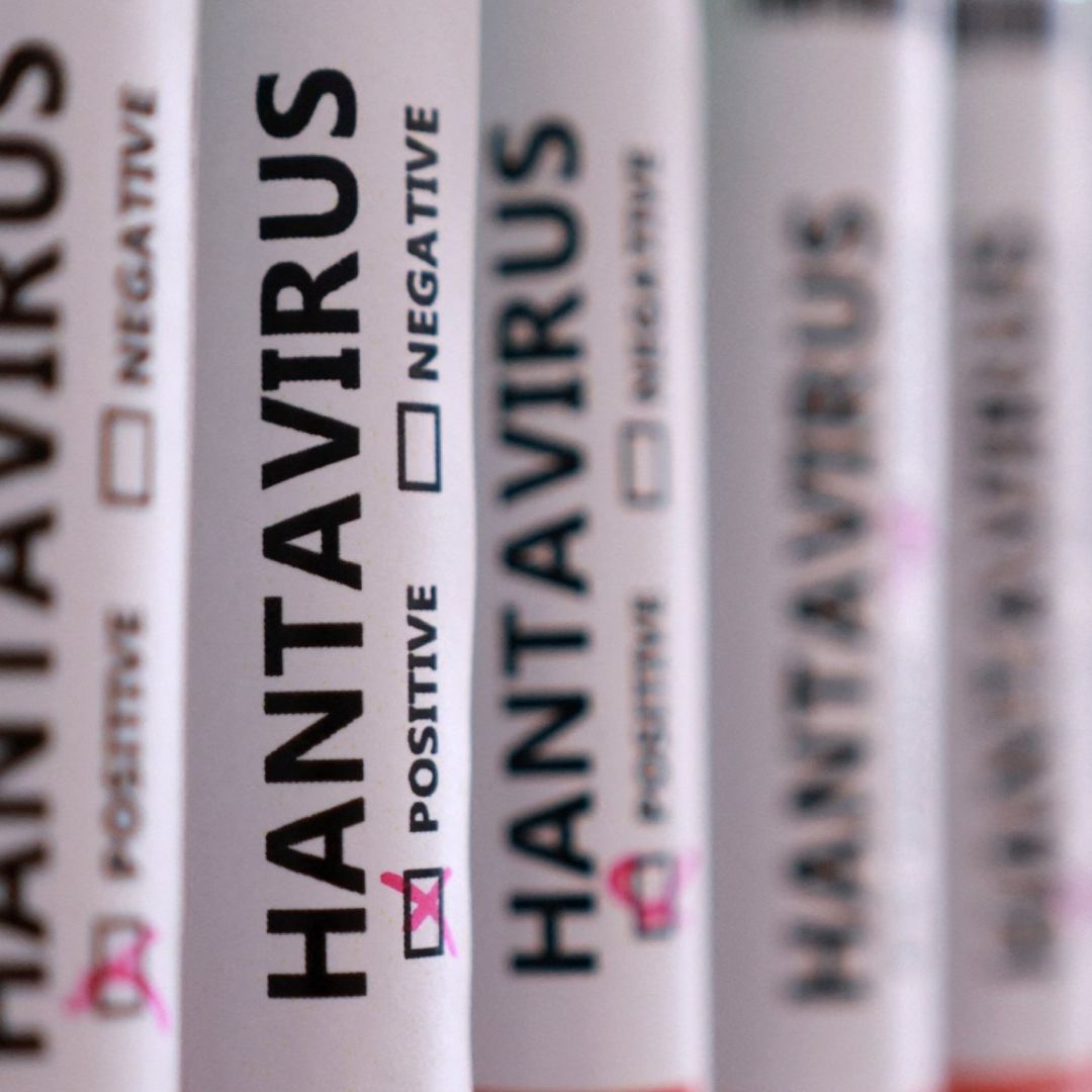 hantavirus