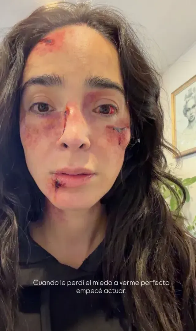 Manelyk subió la foto donde se ve con el rostro golpeado.