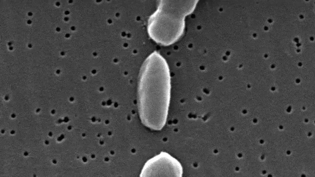 Bacterias bajo el microscopio, semejantes a LUCA