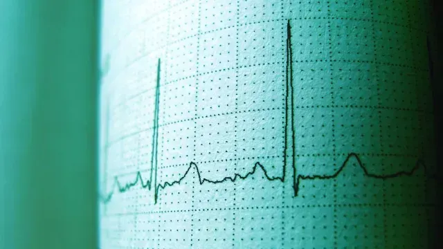 Imagen de un electrocardiograma sobre una hoja