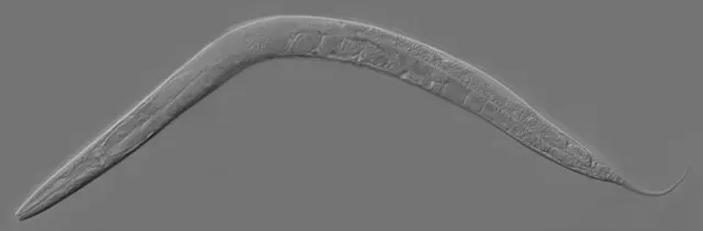 Gusano transparente bajo el microscopio