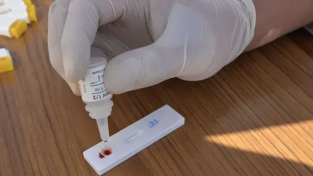 Los centros de atención médica hacen estas pruebas de manera gratuita.