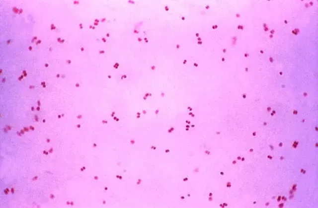 Bacterias de la gonorrea bajo el microscopio