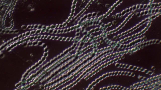 Cianobacterias bajo el microscopio