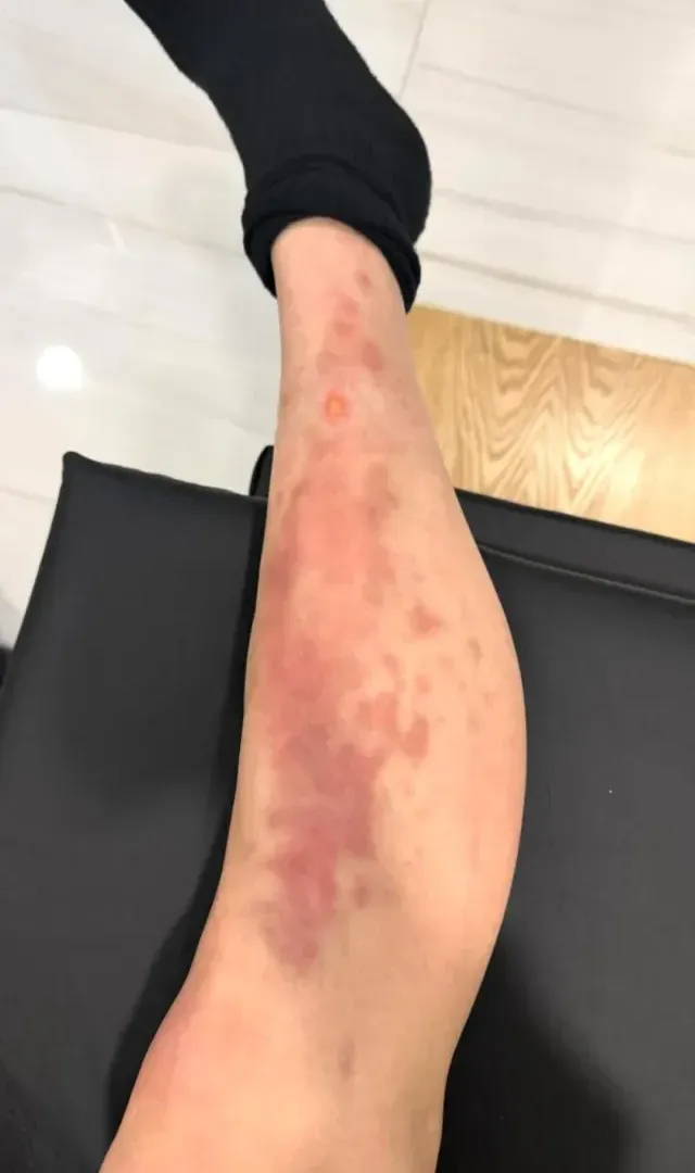 Taylor-Momsen-Asi-Quedo-Pierna-Araña-Mexico