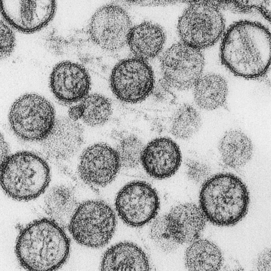 Confirman la Cepa Andes de Hantavirus Transmisible Entre Humanos en Pasajeros de Crucero.