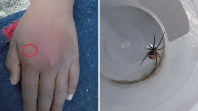Niño se deja picar por araña para convertirse en Spider Man