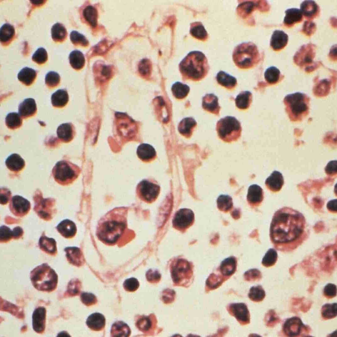 ¿De dónde salió la variante Andes del hantavirus?