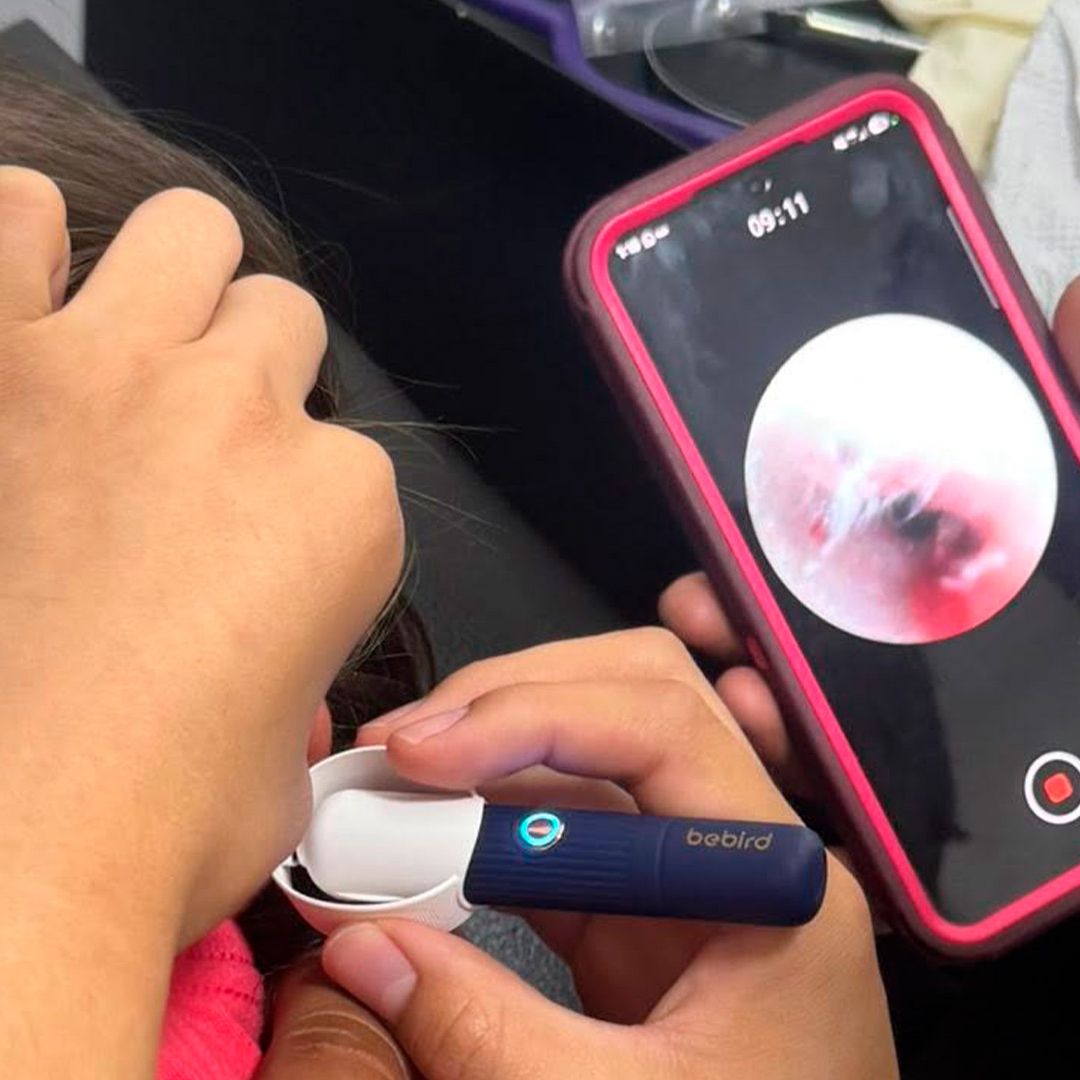 Una niña de 4 años en Acuña, Coahuila, sufría un dolor de oído que resultó ser un ciempiés.