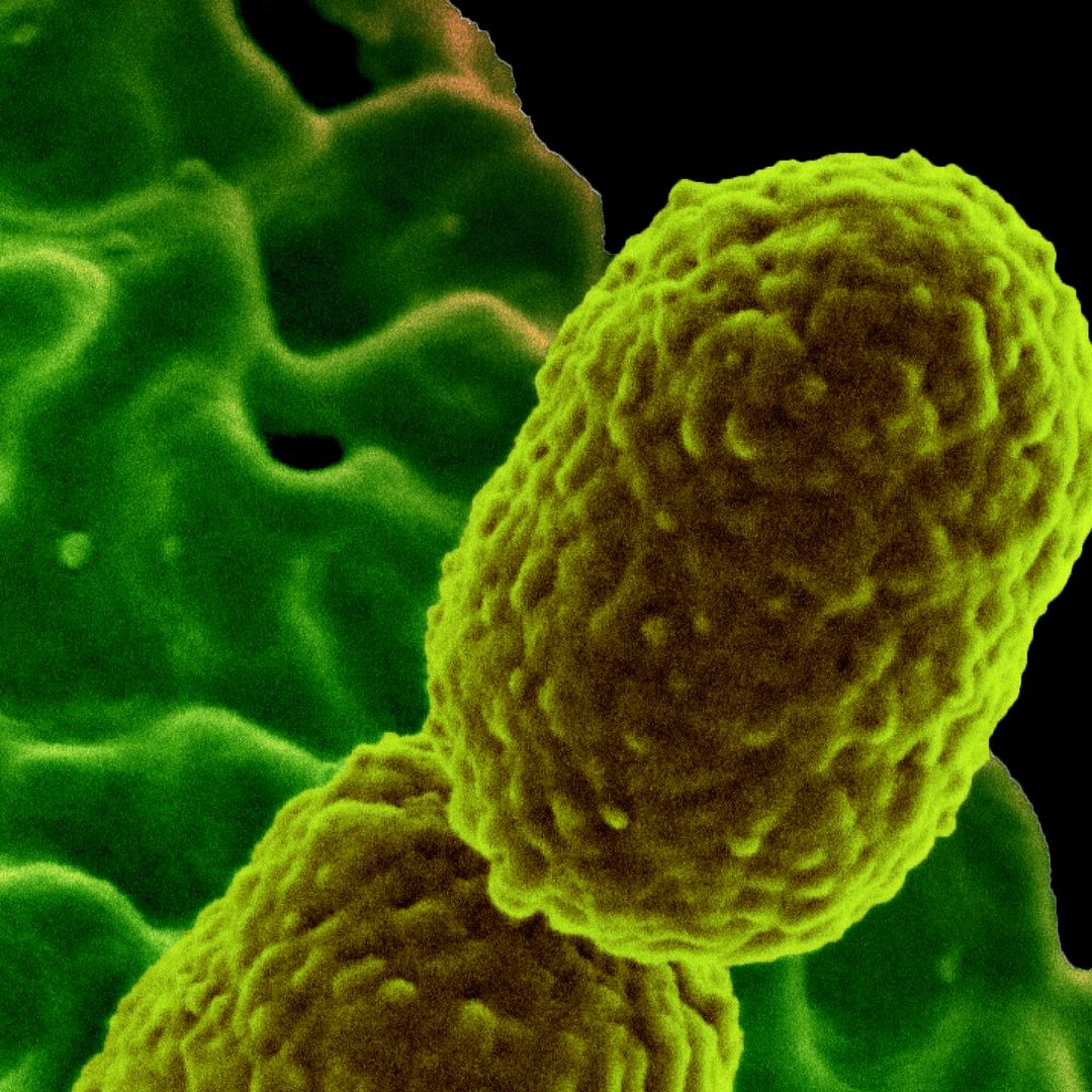 Bacteria Klebsiella, vinculada a la muerte de bebés en el IMSS