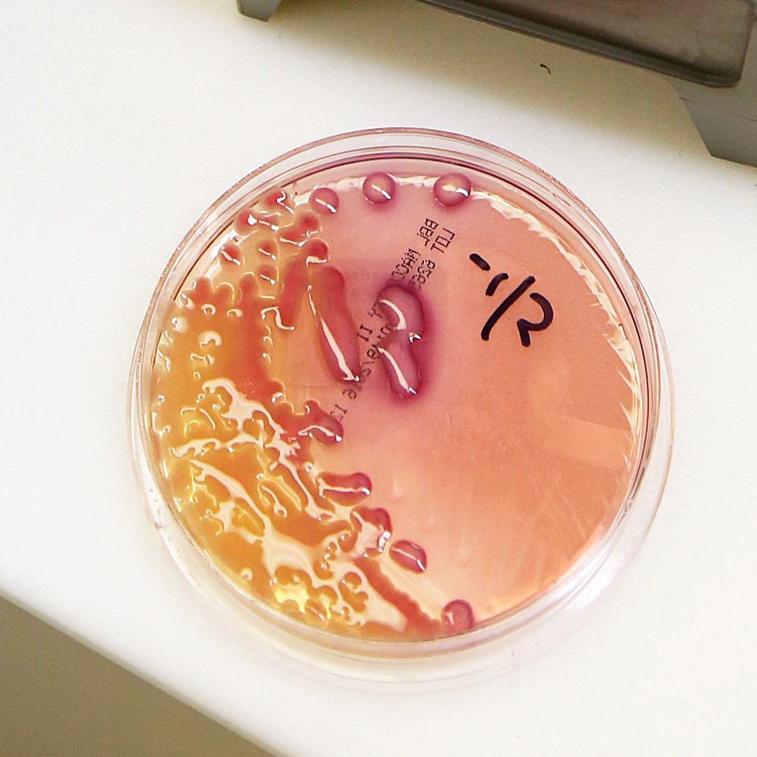 Klebsiella pneumoniae en el laboratorio del Berkeley Medical Center en Virginia Occidental, en diciembre 2016. Foto: Reuters | Archivo