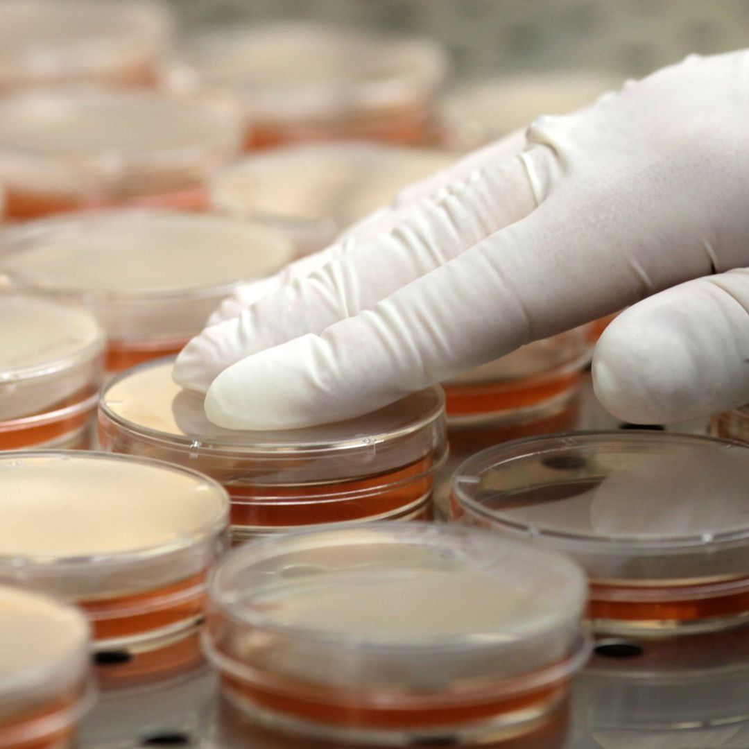 Especialista prepara placas de Petri para un análisis de bacteria en Riga, en junio 2011. Foto: Reuters | Archivo