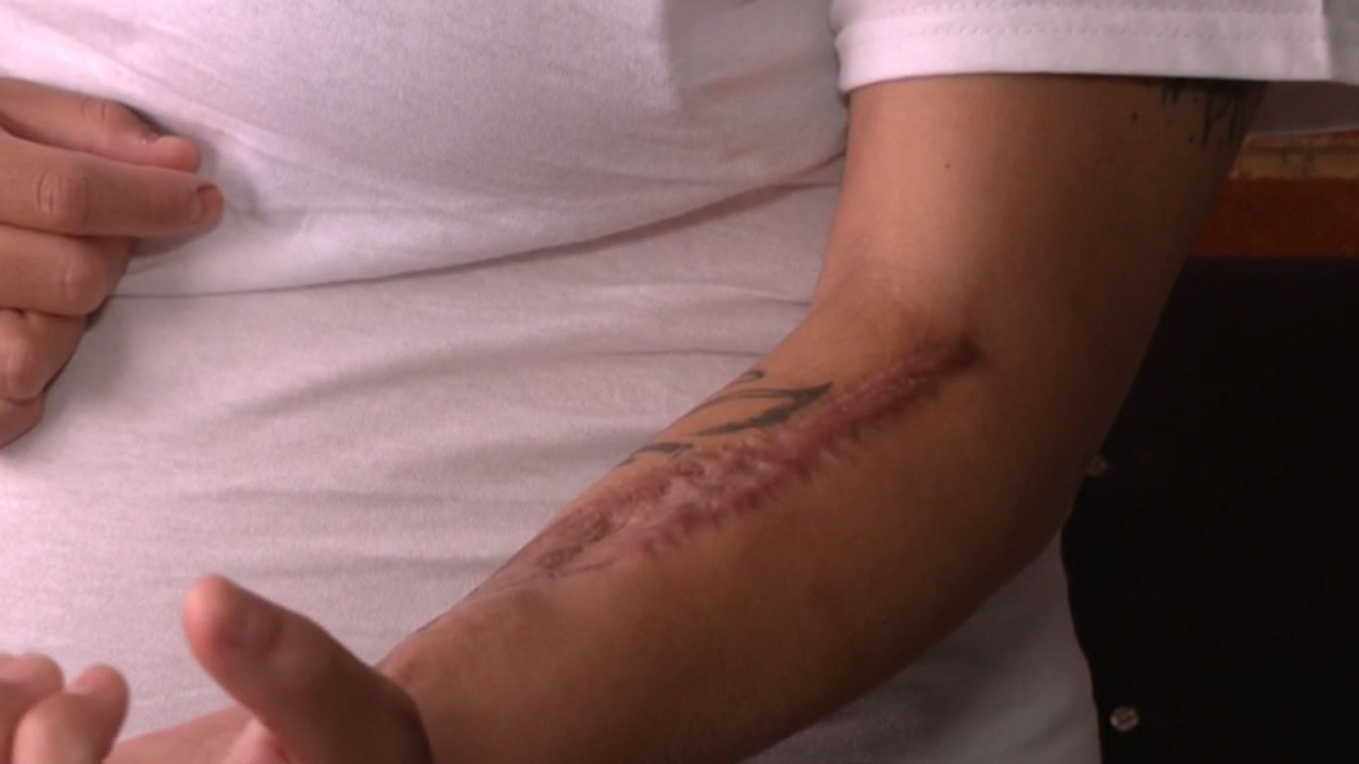 La bala ingresó por la cara, el tórax y salió por el brazo