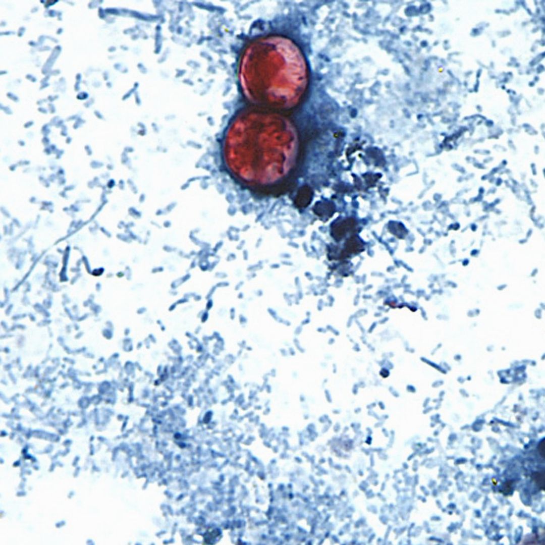 Muestra de Cyclospora cayetanensis, diarrea explosiva