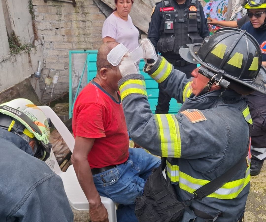 Un adulto mayor resultó lesionado por el flamazo de la estufa de gas