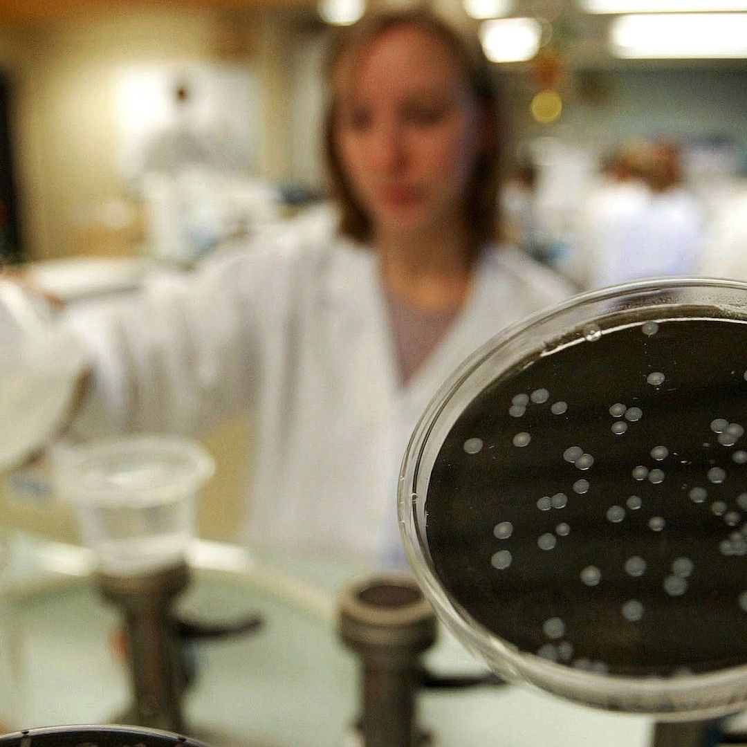 Cultivo de Legionella