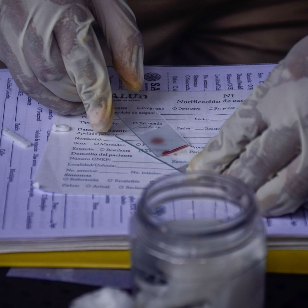 Prueba de malaria