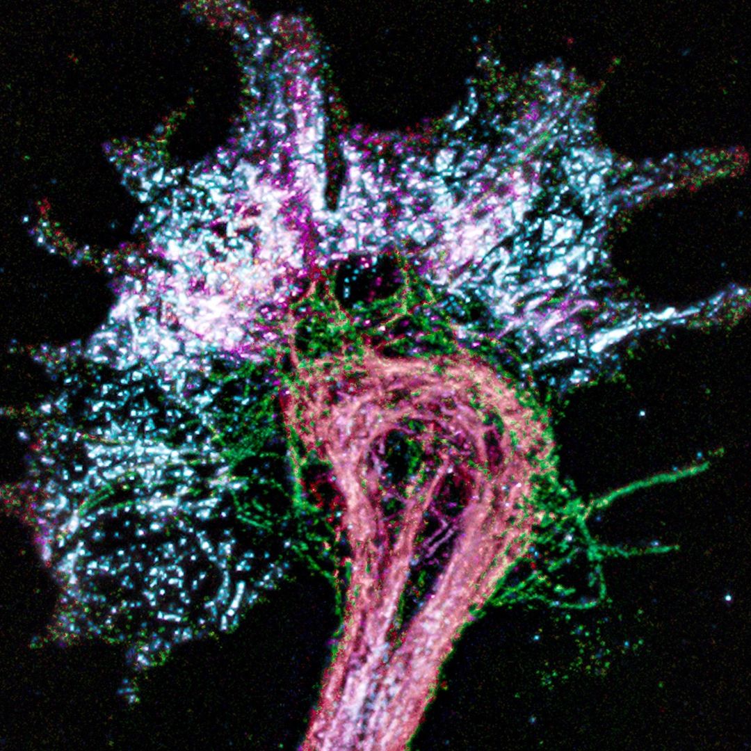 Neurona bajo el microscopio
