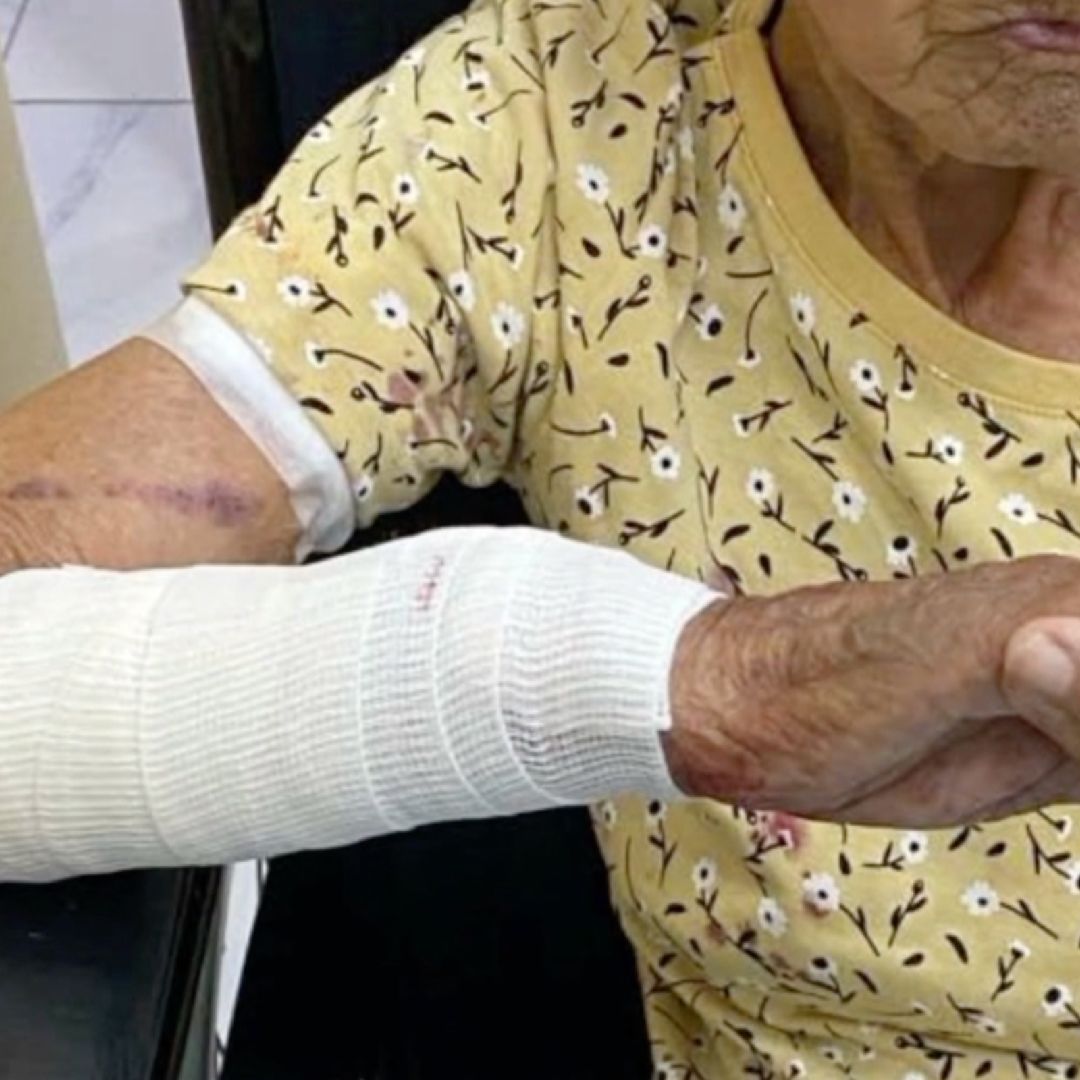 Perro Ataca a Mujer en Nuevo Laredo