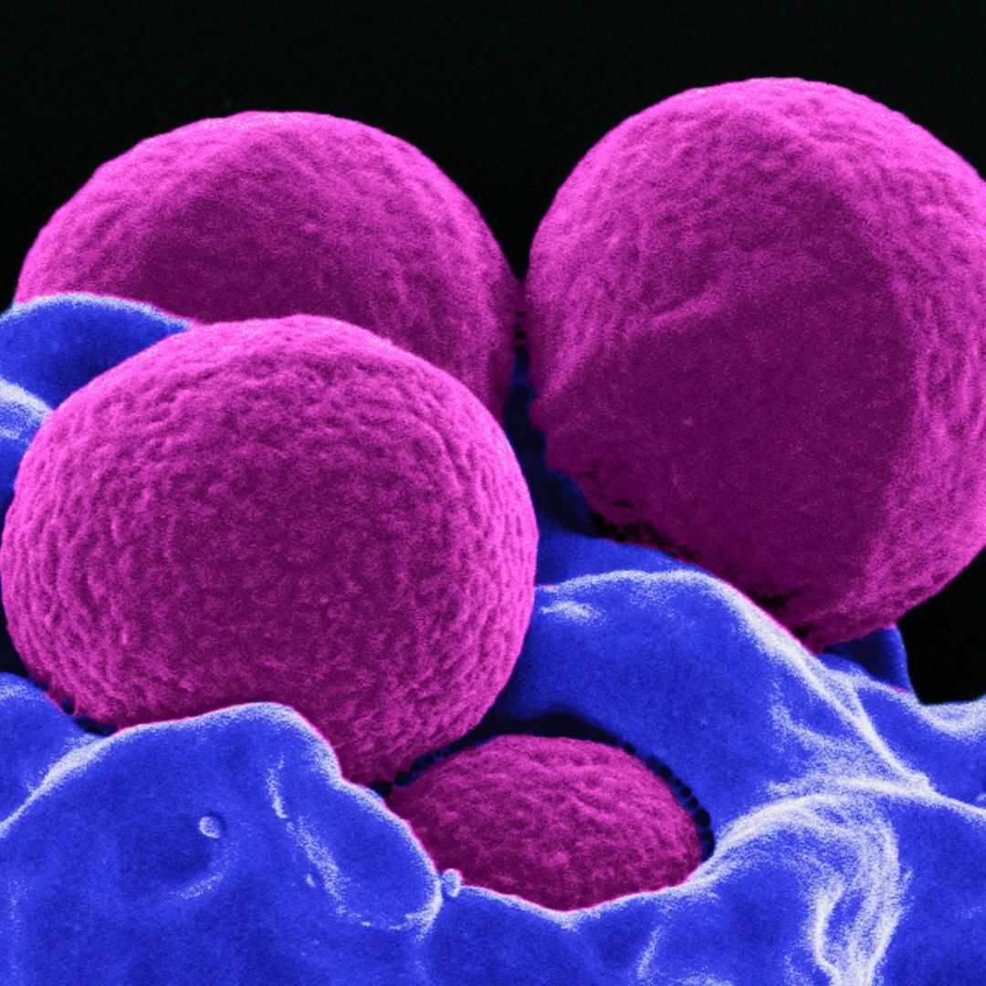 Fotografía de la superbacteria Staphylococcus aureus