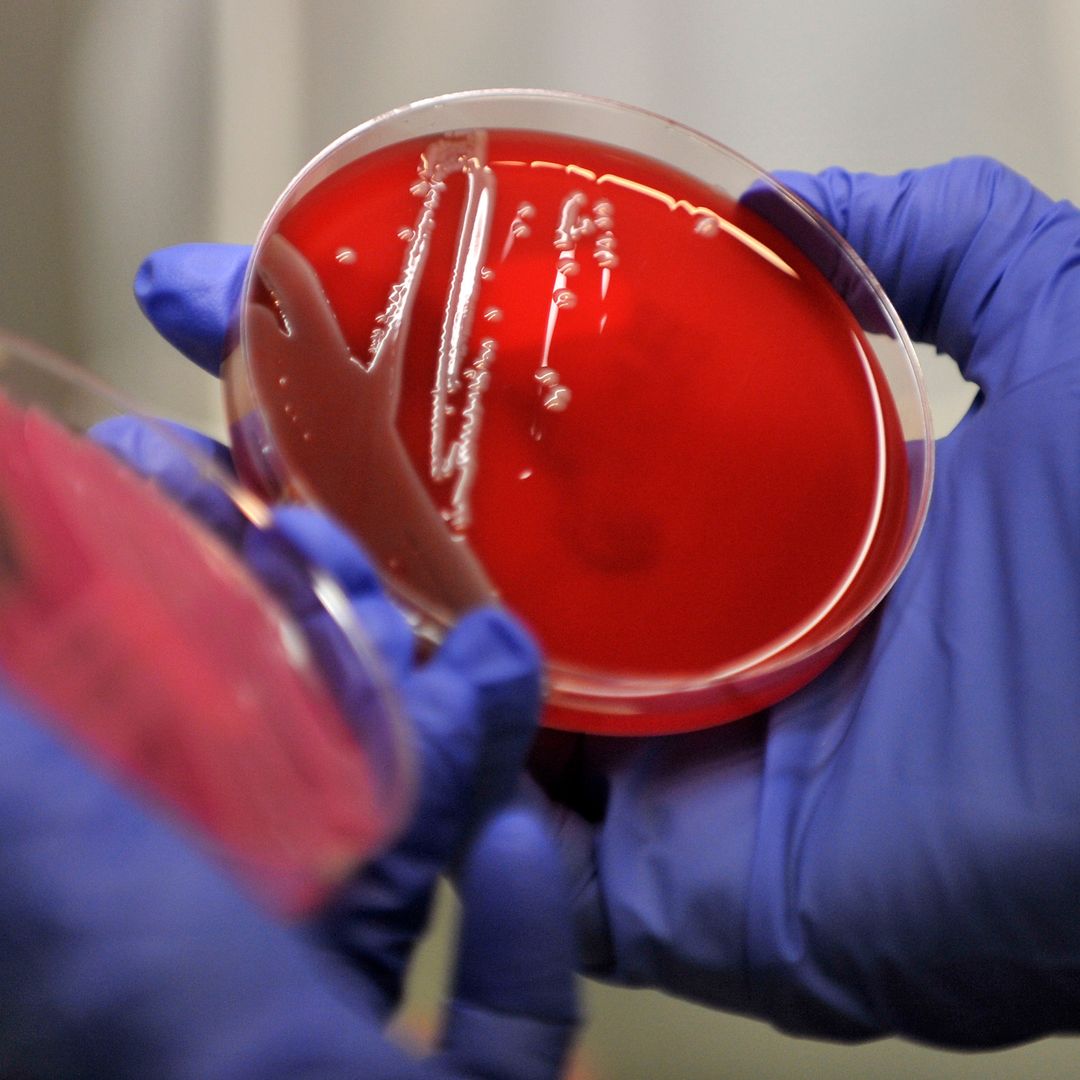 Muestra de bacteria en laboratorio de microbiología